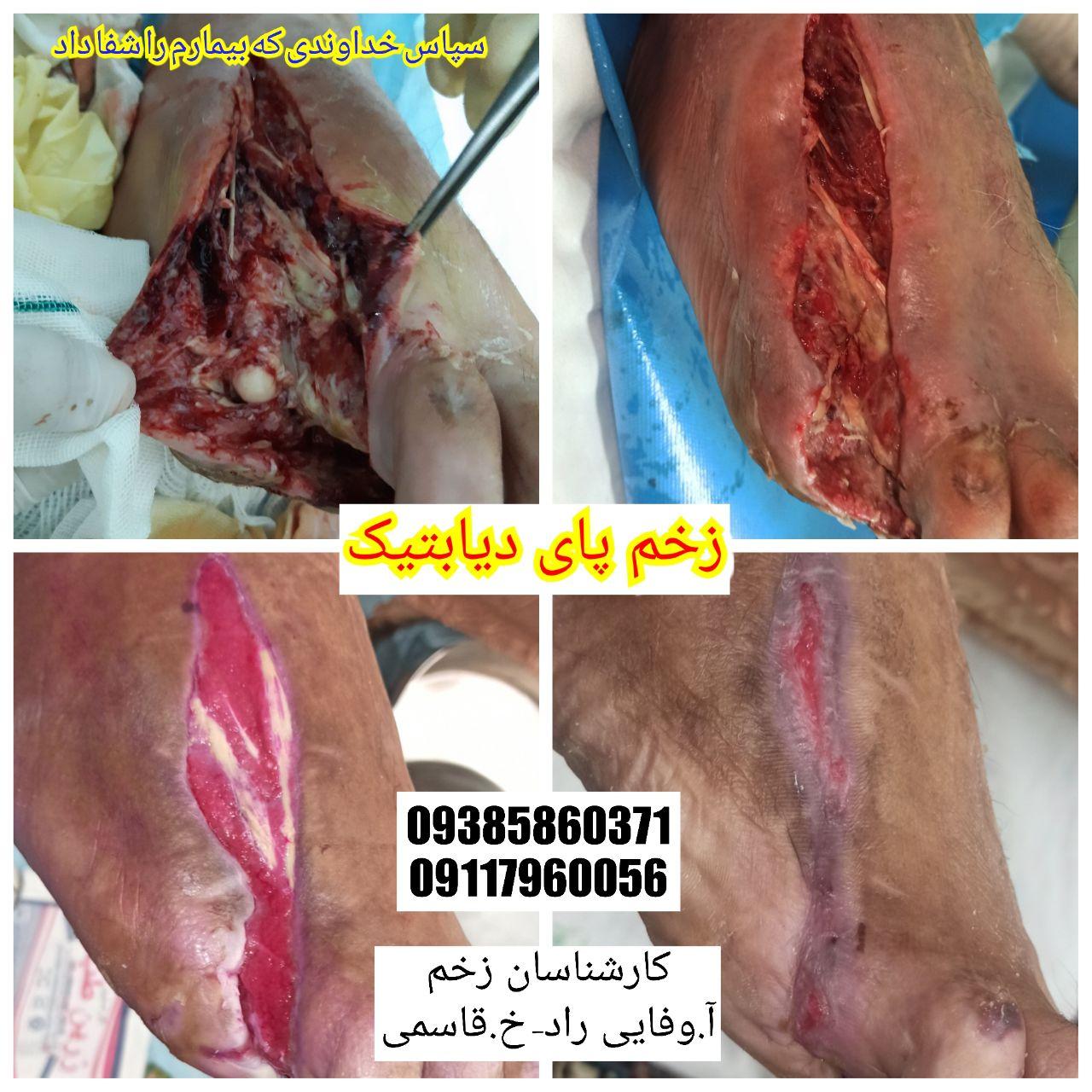 سپاس خداوندی که بیمارم را شفا داد 