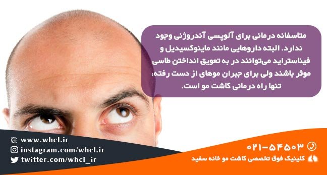 علت ریزش مو